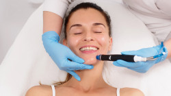 Peeling visage dans le Val-d'Oise