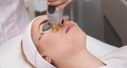 Quel peeling visage choisir pour corriger les cicatrices d'acné  