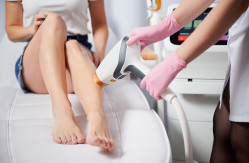 Qui contacter pour une épilation définitive des jambes